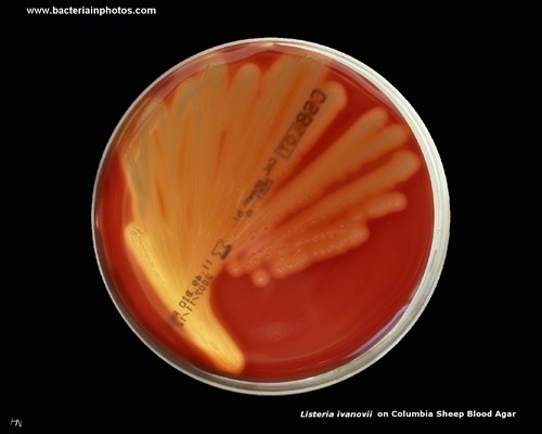 listeria on blood agar